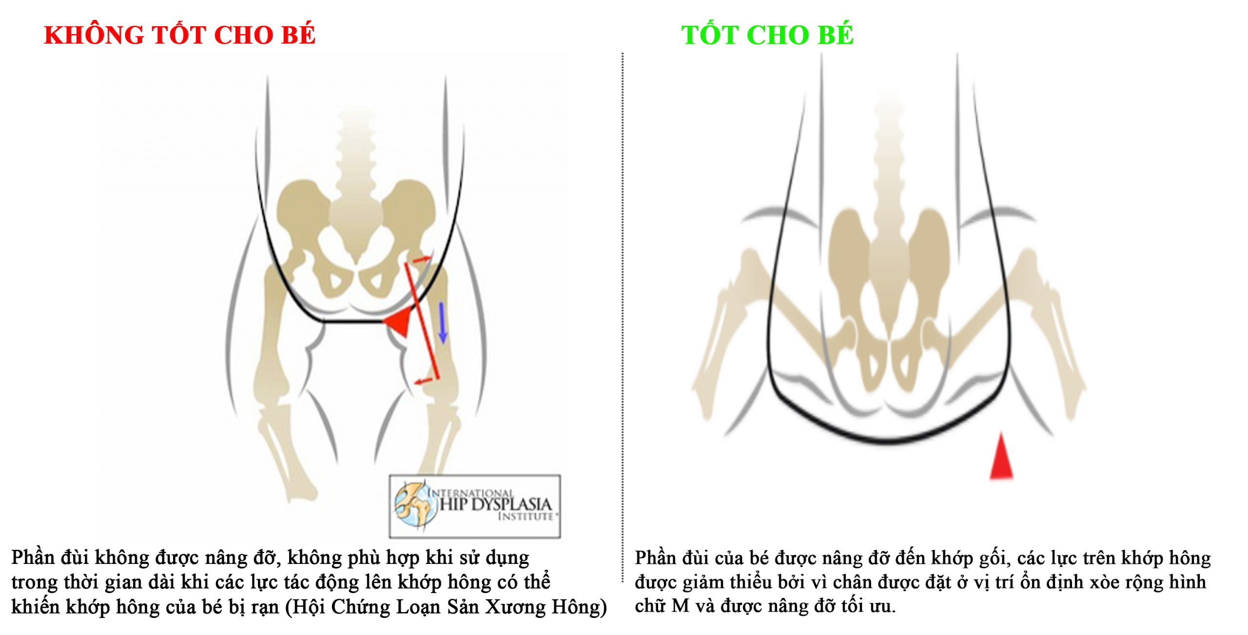 Tư thế địu chuẩn: Chìa khóa cho hông khỏe bé