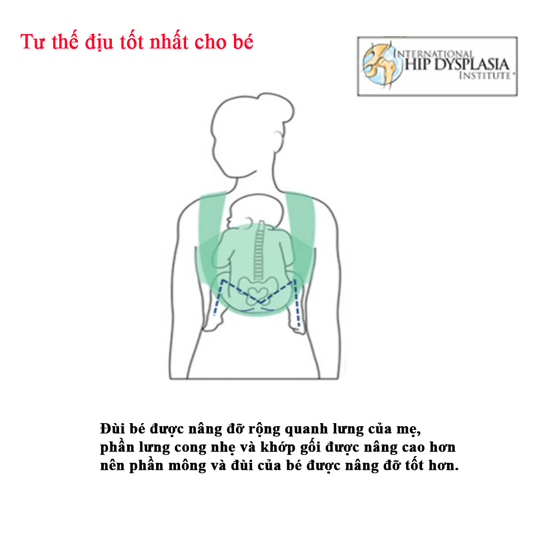 Địu được Viện Loạn Sản Khớp Háng Quốc Tế chứng nhận an toàn cho sự phát triển hông của trẻ