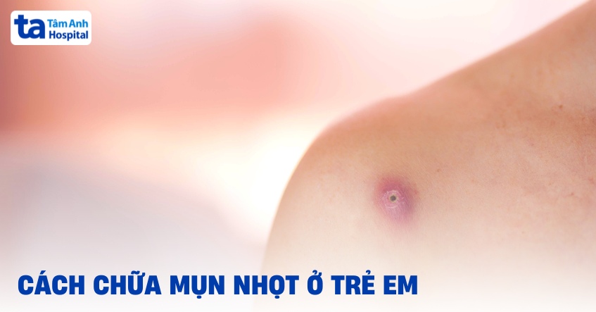 Cách chữa mụn nhọt cho bé hiệu quả và an toàn