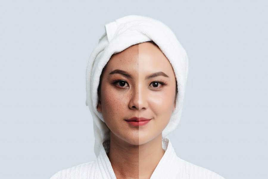 Da thải độc như thế nào để cải thiện làn da sần sùi, thâm sạm