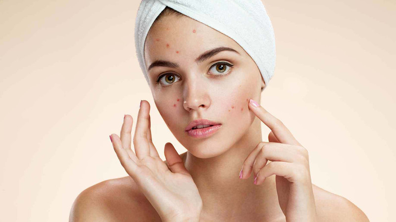 Hàm lượng đường và chất béo cao trong 1 cái bánh trung thu có thể ảnh hưởng đến làn da bị mụn