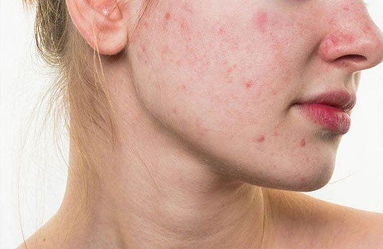 Sữa chua không đường trong bát nhỏ, biểu tượng cho nguyên liệu tự nhiên để đắp mặt nạ làm đẹp da