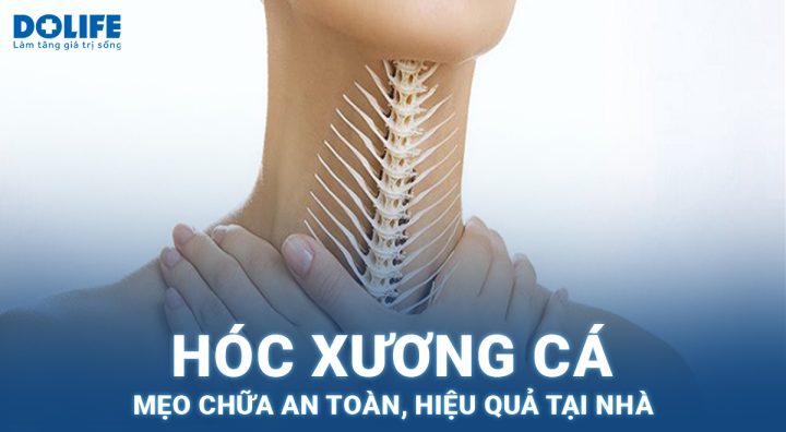 Cách Xử Lý Khi Bị Hóc Xương Cá An Toàn Và Hiệu Quả