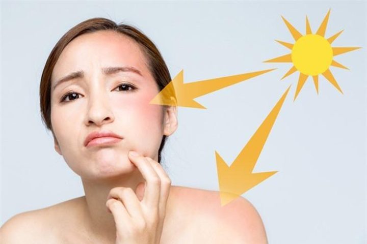 Cách Chống Nắng Không Cần Kem Hiệu Quả và An Toàn Toàn Diện