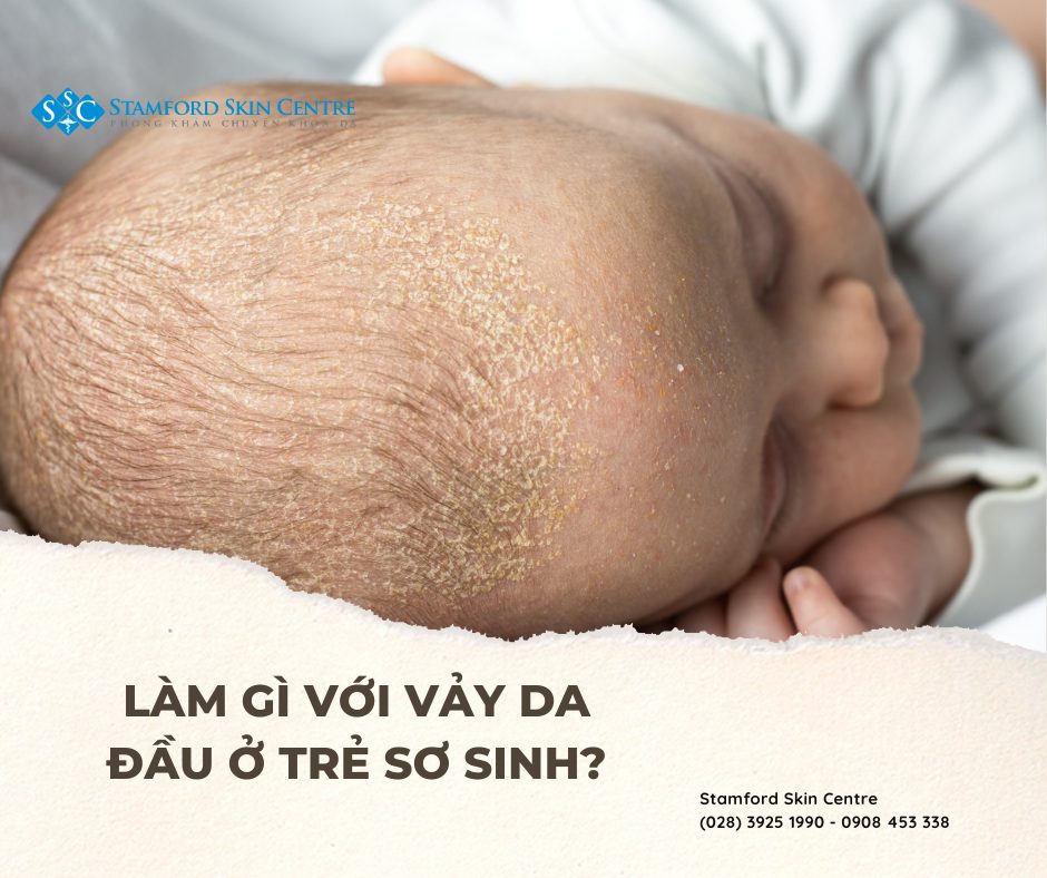 Đánh giá đầu trẻ sơ sinh bình thường và toàn diện: Hướng dẫn chi tiết cho cha mẹ