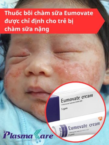 Thuốc Bôi Chàm Cho Trẻ Sơ Sinh An Toàn, Hiệu Quả