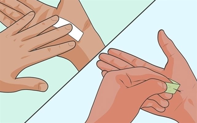 Mẹo lấy dằm ra khỏi tay an toàn, hiệu quả tại nhà