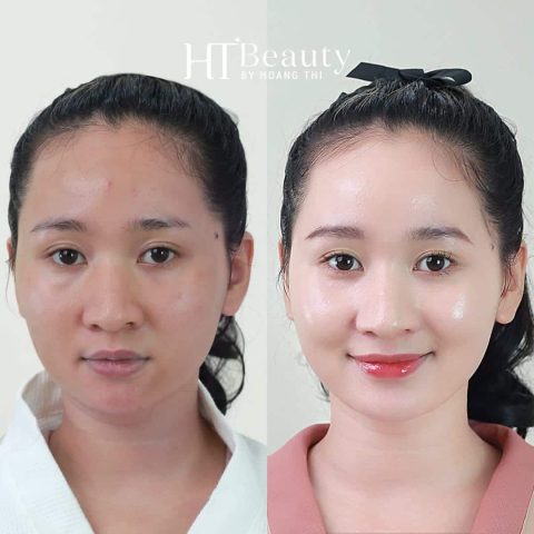 Làm Trắng Da Mặt Nhanh Nhất Trong 1 Tuần: Hướng Dẫn Chi Tiết
