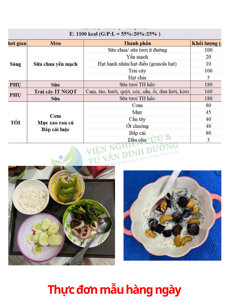 Hình ảnh bé S 8 tuổi sau khi giảm 6kg nhờ can thiệp dinh dưỡng