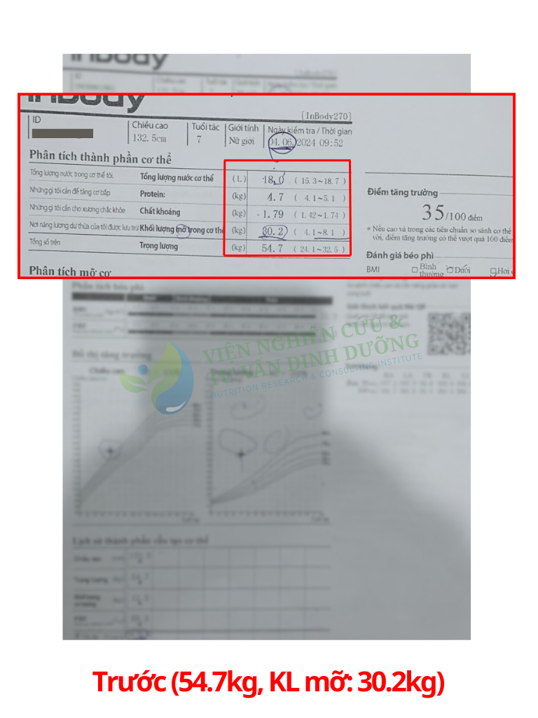 Kết quả Inbody của bé S trước can thiệp dinh dưỡng tại NRECI