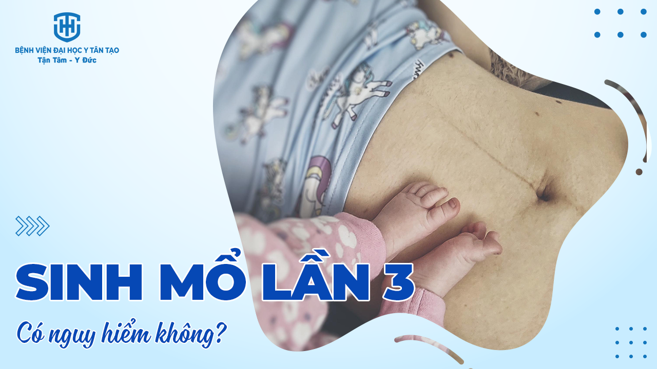 Sinh Mổ Lần 3 Mổ Dọc Hay Ngang: Giải Đáp Chi Tiết Cho Mẹ Bầu