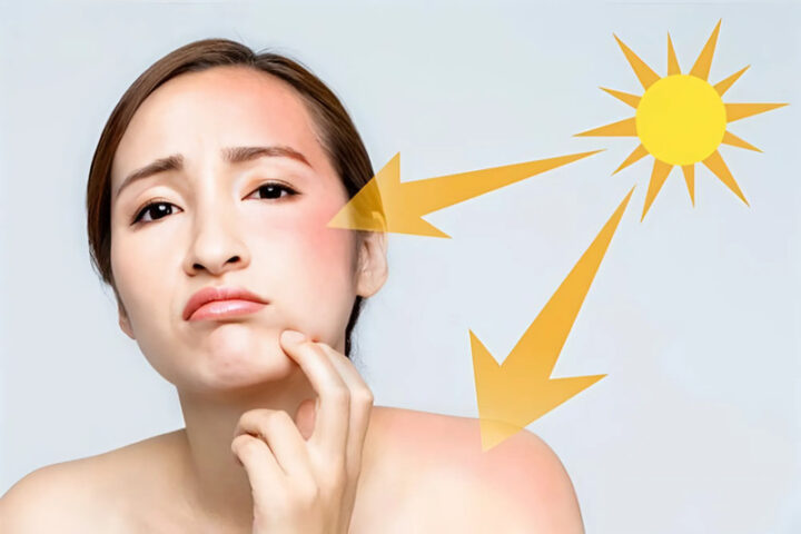 Kem Chống Nắng Cho Mặt Tốt Nhất Hiện Nay: Lựa Chọn Hoàn Hảo Cho Mọi Loại Da