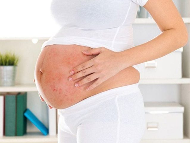 Bị Dị Ứng Khi Mang Thai: Nguyên Nhân, Triệu Chứng Và Cách Xử Trí An Toàn