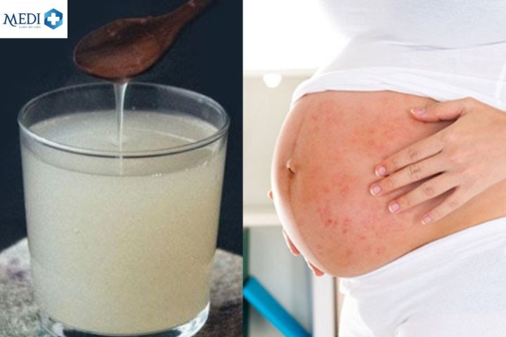Bà Bầu Uống Bột Sắn Dây Được Không: Lợi Ích & Lưu Ý