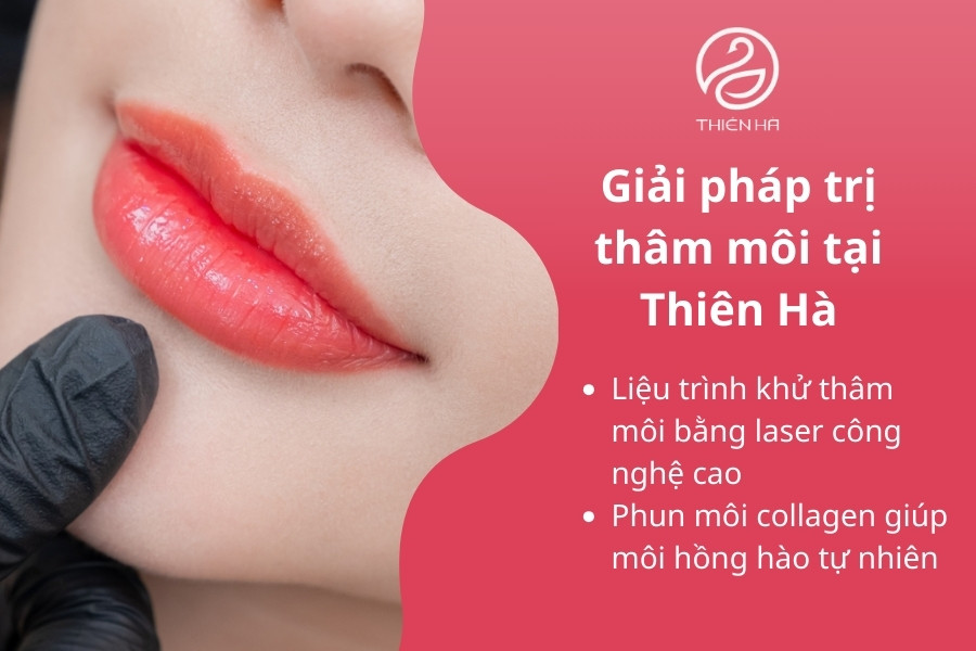 Các giải pháp trị thâm môi chuyên sâu bằng công nghệ hiện đại tại Viện Thẩm Mỹ Thiện Hà