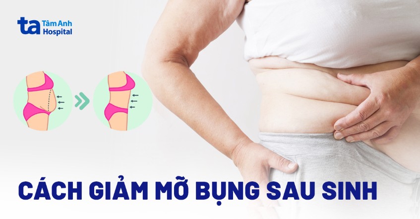 Cách Tập Giảm Mỡ Bụng Sau Sinh An Toàn & Hiệu Quả Tại Nhà