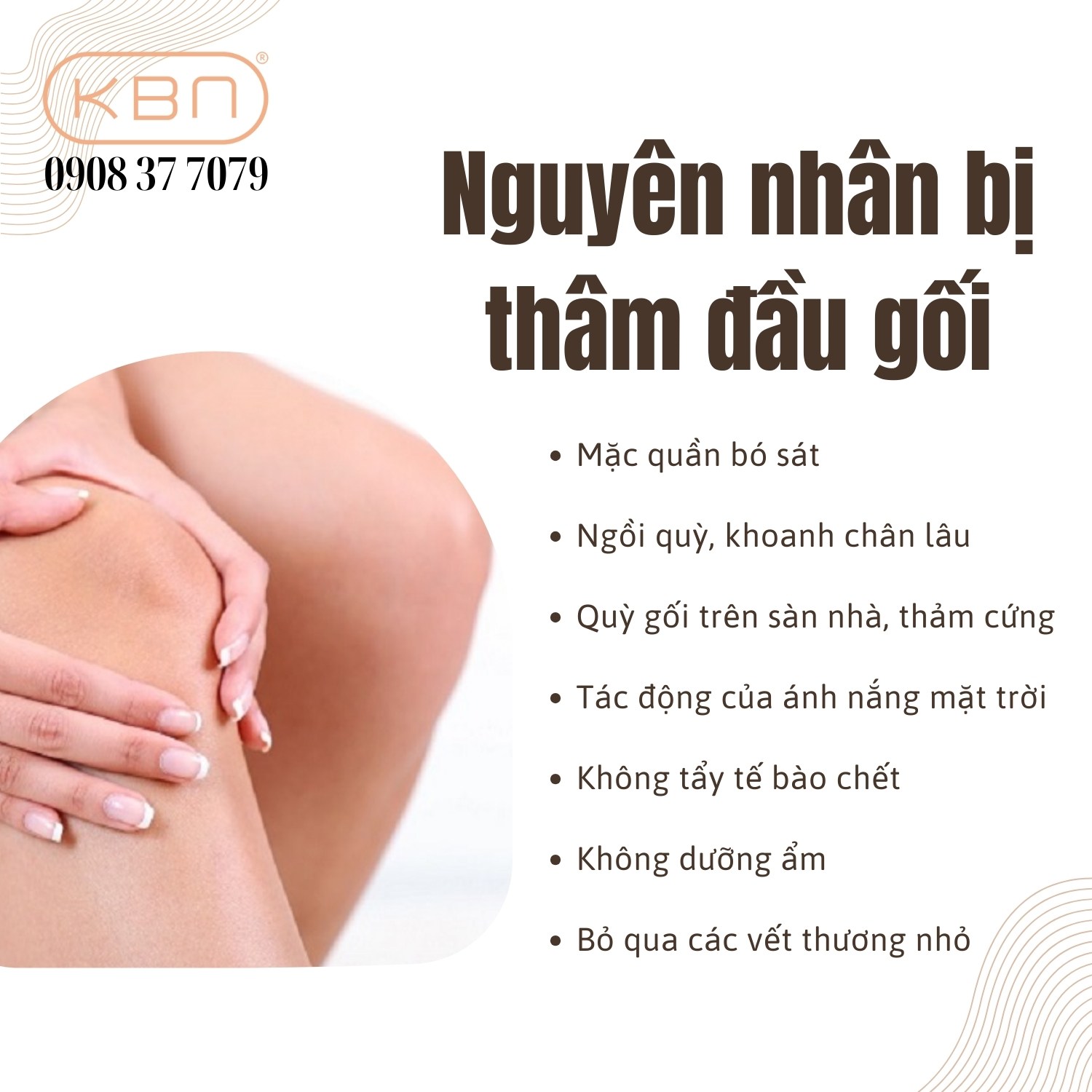 Trị Thâm Đầu Gối Nhanh Nhất: Bí Quyết Đánh Bay Vết Thâm Hiệu Quả