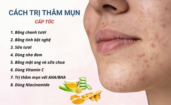 Cách Trị Thâm Trên Mặt Nhanh Nhất & Hiệu Quả Từ Chuyên Gia