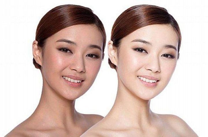 Mặt Nạ Sữa Tươi Không Đường: Sự Thật Đằng Sau Làn Da Mịn Màng và Những Lưu Ý Quan Trọng