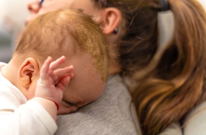 Trẻ Sơ Sinh Gãi Đầu Gãi Tai Khi Ngủ: Nguyên Nhân & Cách Xử Lý Hiệu Quả