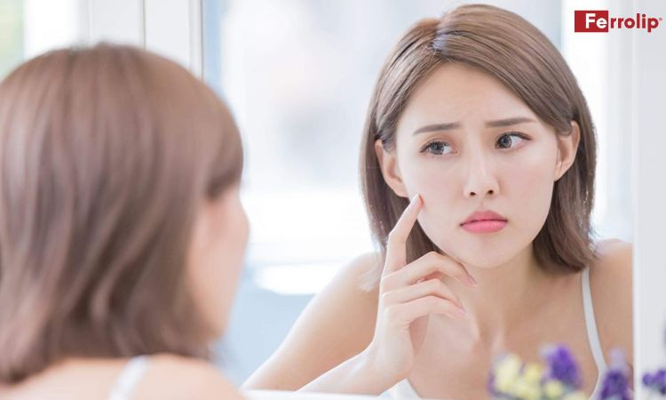 Da mặt nổi mụn khi mang thai do thay đổi nội tiết tố