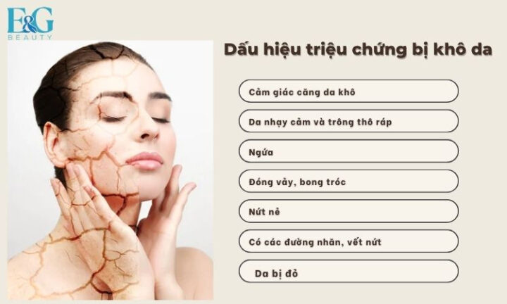 Dấu hiệu nhận biết da khô và các cách dưỡng ẩm cho da khô tại nhà