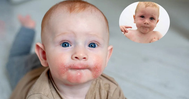 Dấu Hiệu Trẻ Không Hợp Sữa Công Thức: Hướng Dẫn Chi Tiết