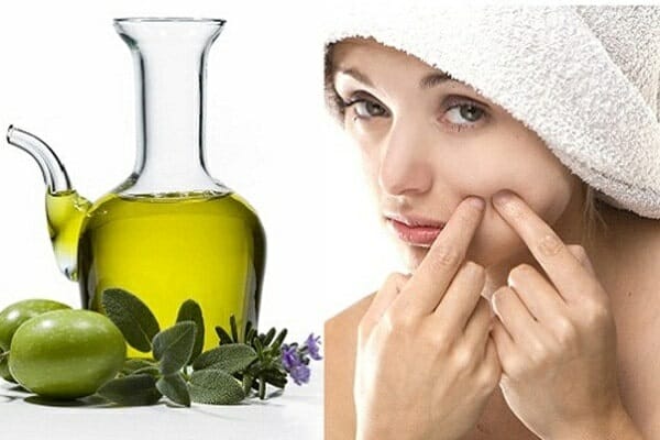 Dầu ô liu là cách trị mụn vết thâm trên mặt hiệu quả