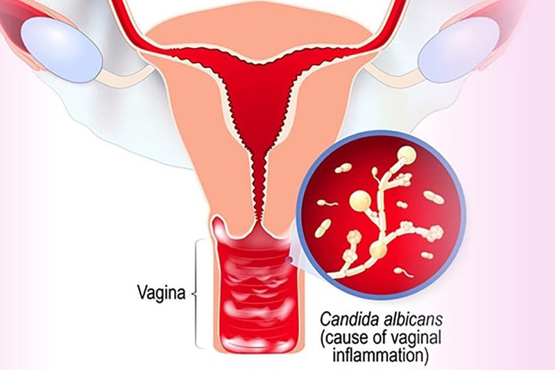 Betadine Xanh Rửa Phụ Khoa Cách Dùng Đúng Chuẩn và Lưu Ý Cần Biết