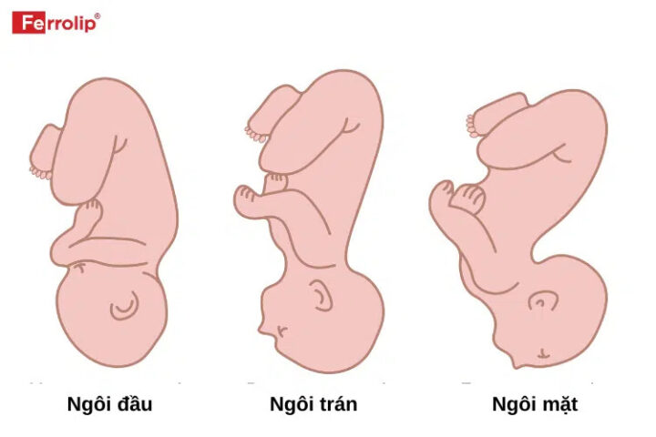 Khi Nào Em Bé Quay Đầu: Thời Điểm, Dấu Hiệu và Ý Nghĩa Quan Trọng