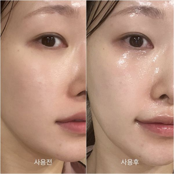 Bôi Kem Dưỡng Ẩm Trước Hay Sau Serum: Hướng Dẫn Chuẩn Chuyên Gia