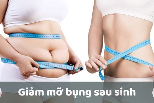 Cách Tập Giảm Mỡ Bụng Sau Sinh An Toàn & Hiệu Quả Tại Nhà