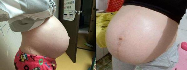 Hình ảnh bụng bầu tụt xuống: Dấu hiệu sắp sinh mẹ cần chuẩn bị - image 1