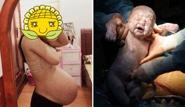 Bụng Tụt Là Như Thế Nào: Dấu Hiệu Và Chuẩn Bị Sinh Nở