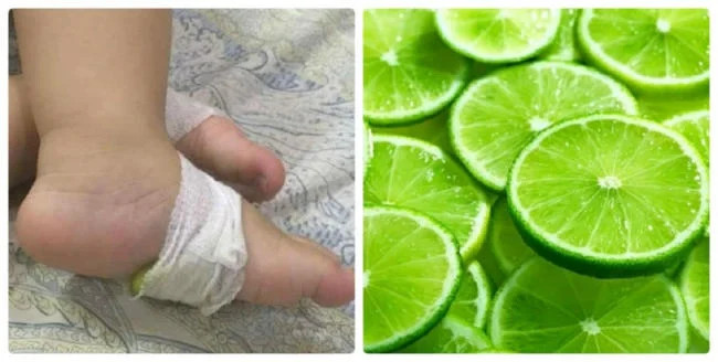 Hạ Sốt Bằng Chanh Cho Trẻ Sơ Sinh: Hướng Dẫn Chi Tiết An Toàn