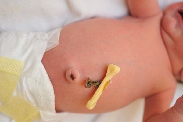 Trẻ sơ sinh bao lâu thì rụng rốn và cách chăm sóc đúng chuẩn