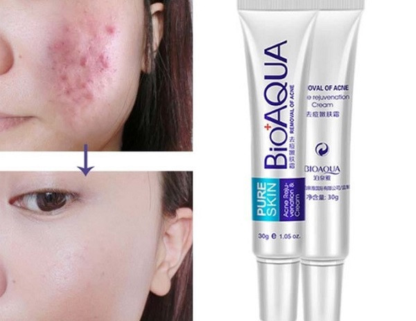 Bioaqua Trị Mụn: Đánh Giá Chuyên Sâu Hiệu Quả và Ưu Nhược Điểm