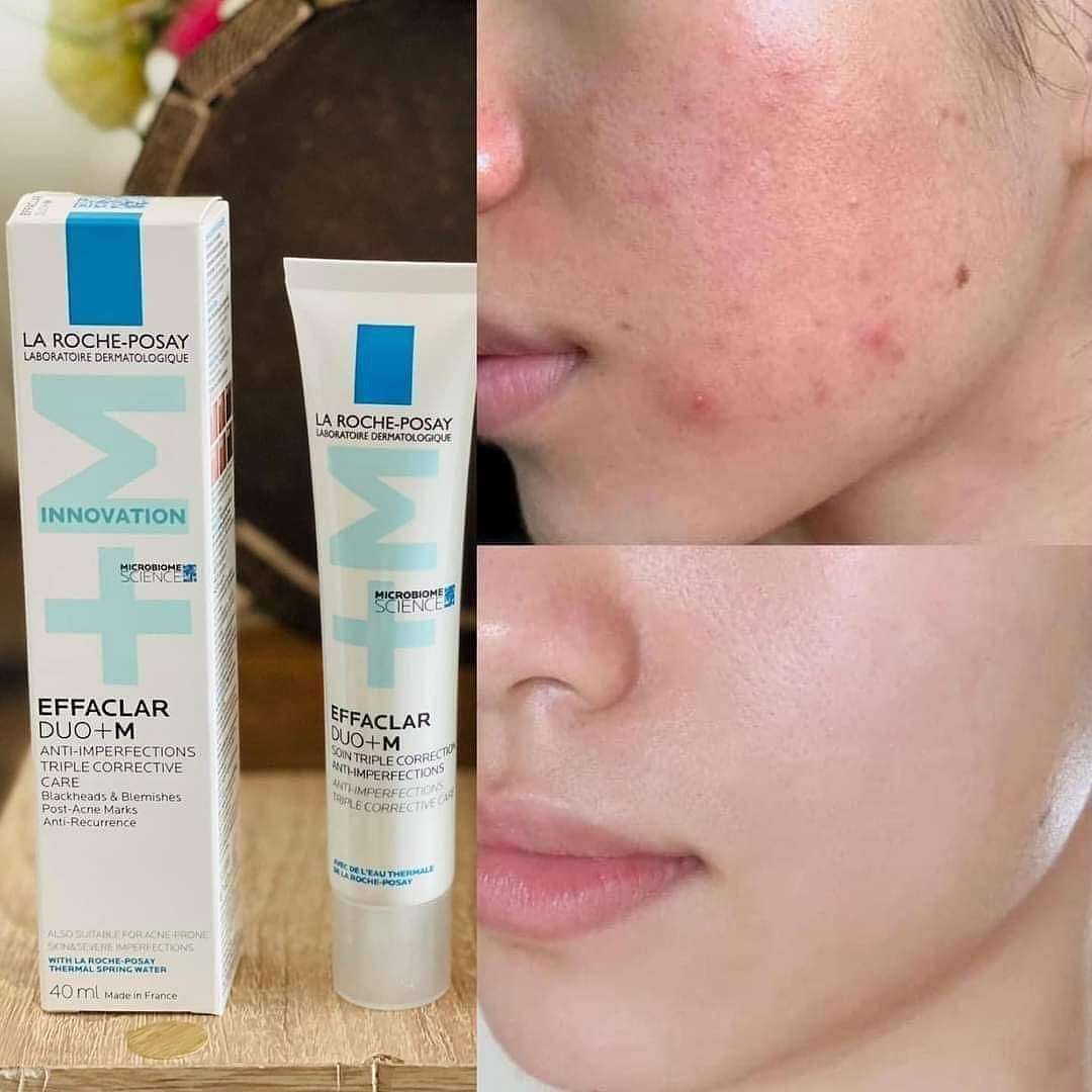 Kết cấu kem trị mụn La Roche Posay Duo