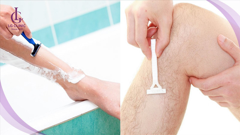 Kỹ thuật cạo lông chân sai cách có thể khiến lông mọc lại nhanh và dày hơn