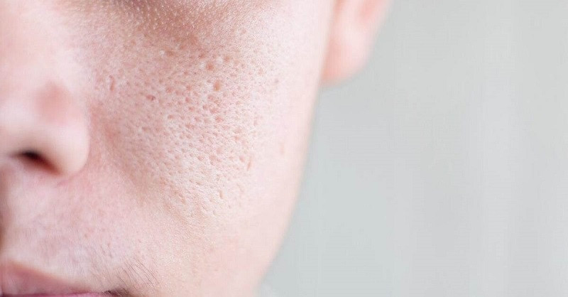 Cách Làm Se Khít Lỗ Chân Lông Bằng Dầu Oliu Hiệu Quả Tại Nhà