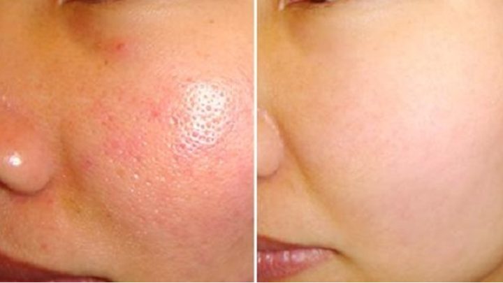 Nên Rửa Mặt Bằng Nước Ấm Hay Nước Lạnh: Hướng Dẫn Chuyên Sâu Từ Chuyên Gia Nên Rửa Mặt Bằng Nước Ấm Hay Nước Lạnh: Hướng Dẫn Chuyên Sâu Từ Chuyên Gia