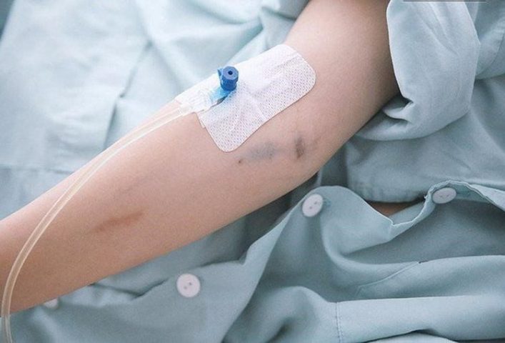 Dung dịch đẳng trương là gì? Khám phá ứng dụng và lưu ý cần biết