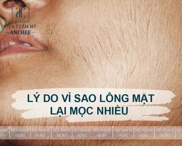 Lông mặt nhiều phải làm sao: Giải pháp hiệu quả từ chuyên gia