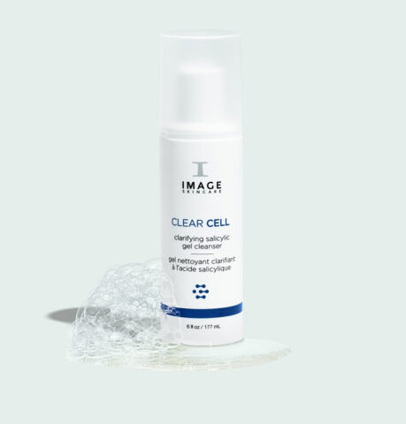 Sữa Rửa Mặt Ngừa Mụn Trị Thâm: Hướng Dẫn Chọn & Top Sản Phẩm