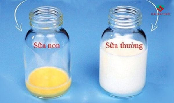 Sữa Non Của Mẹ Có Màu Gì? Giải Mã Toàn Diện