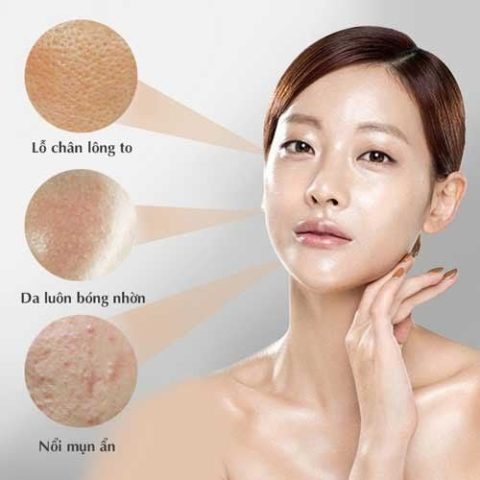 Các Bước Chăm Sóc Da Dầu Cơ Bản Chuẩn Chuyên Gia