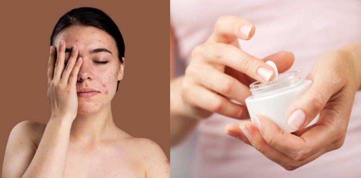 Mỹ phẩm hết hạn: Rủi ro sức khỏe, cách nhận biết và xử lý đúng