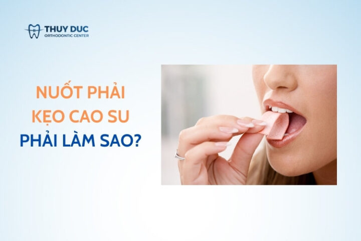 Người lớn và trẻ em nuốt kẹo cao su có bị sao không và cách xử lý an toàn
