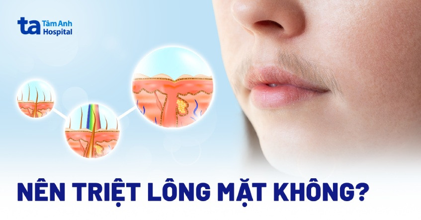Có Nên Triệt Lông Mặt Không? Phân Tích Chuyên Sâu Từ A-Z