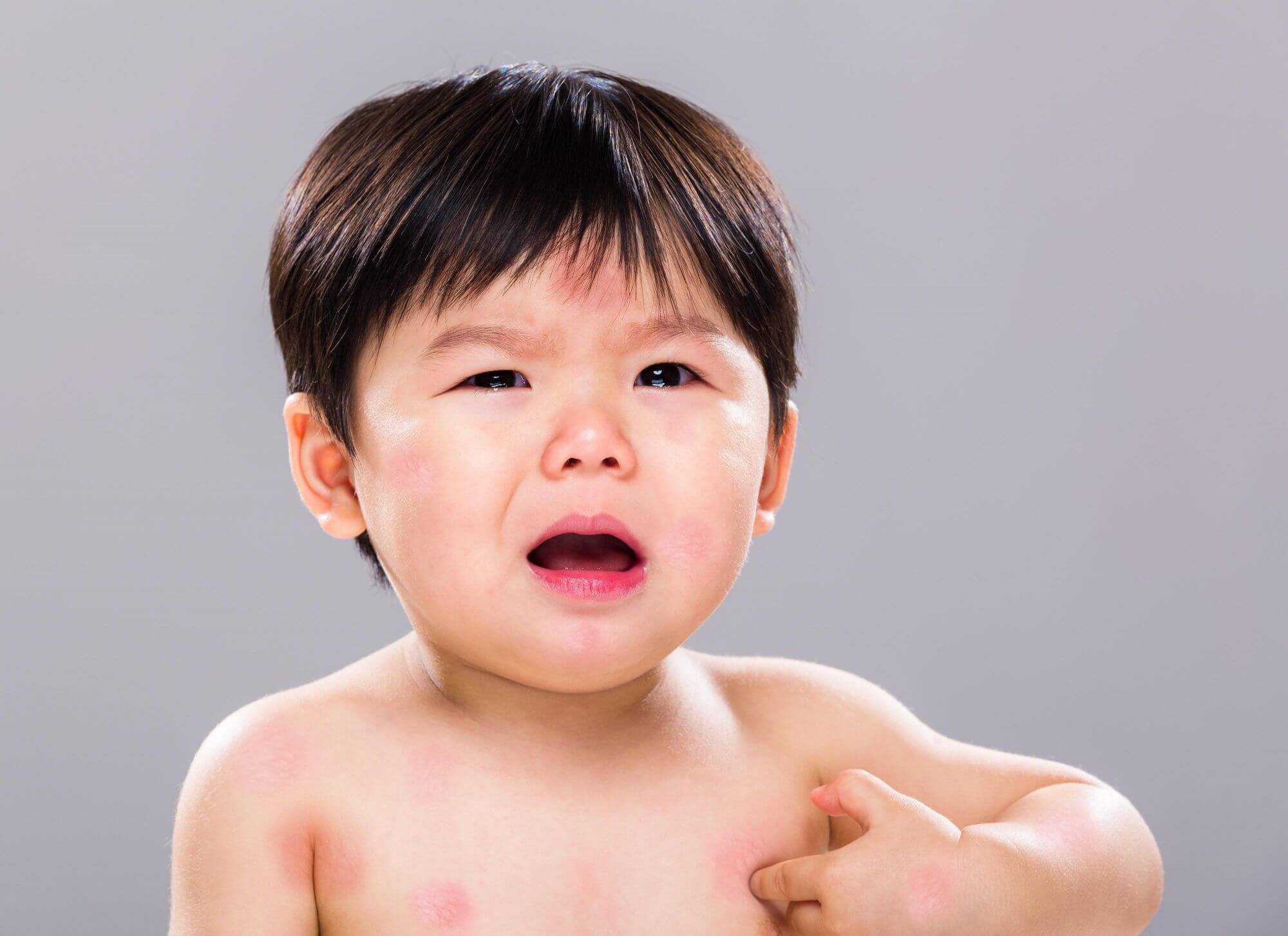 Sữa cho Trẻ Dị Ứng Đạm Sữa Bò: Hướng Dẫn Toàn Diện